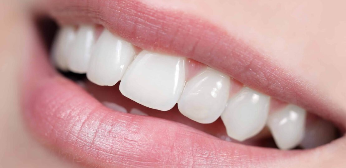 Close up of white, shiny and healthy smile